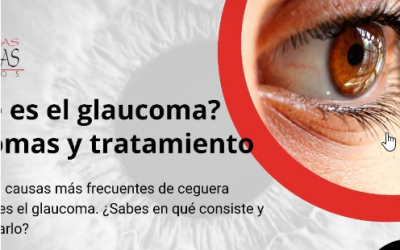 ¿Qué es el glaucoma? Síntomas y tratamiento